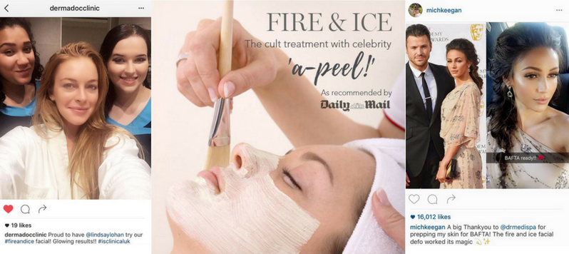 Fire and Ice Facial treatment Prestbury Cheshire 